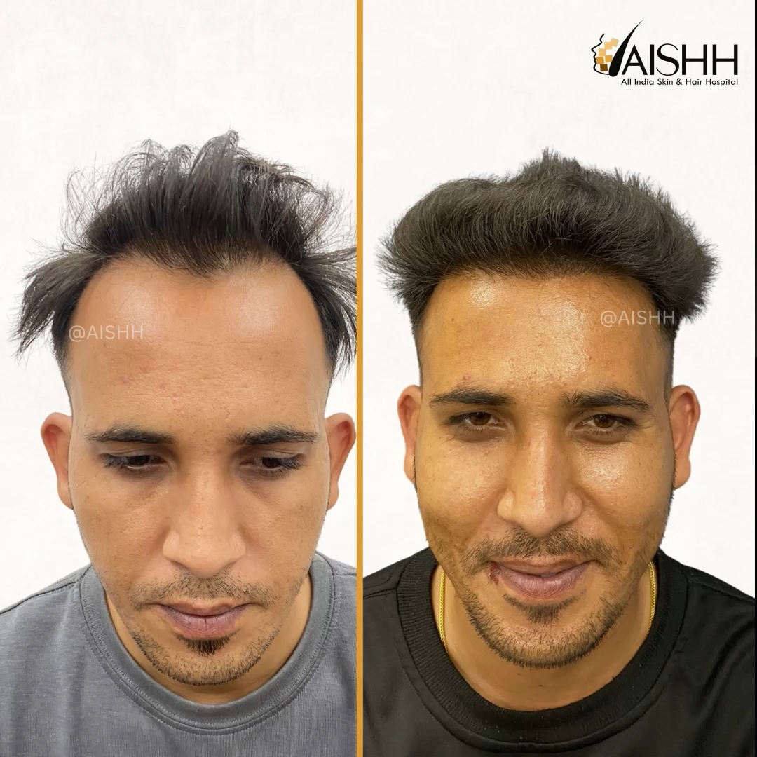 Transformation 1