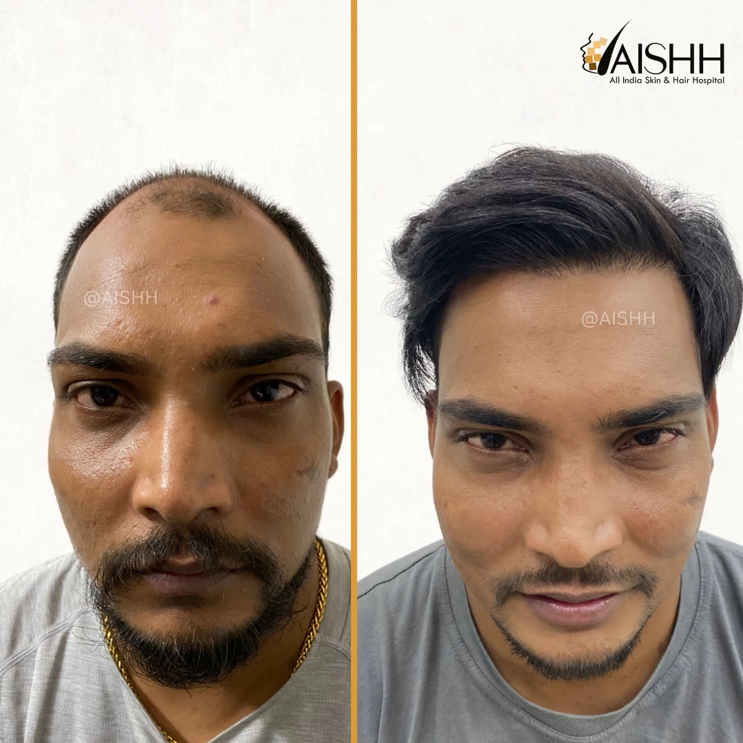 Transformation 4